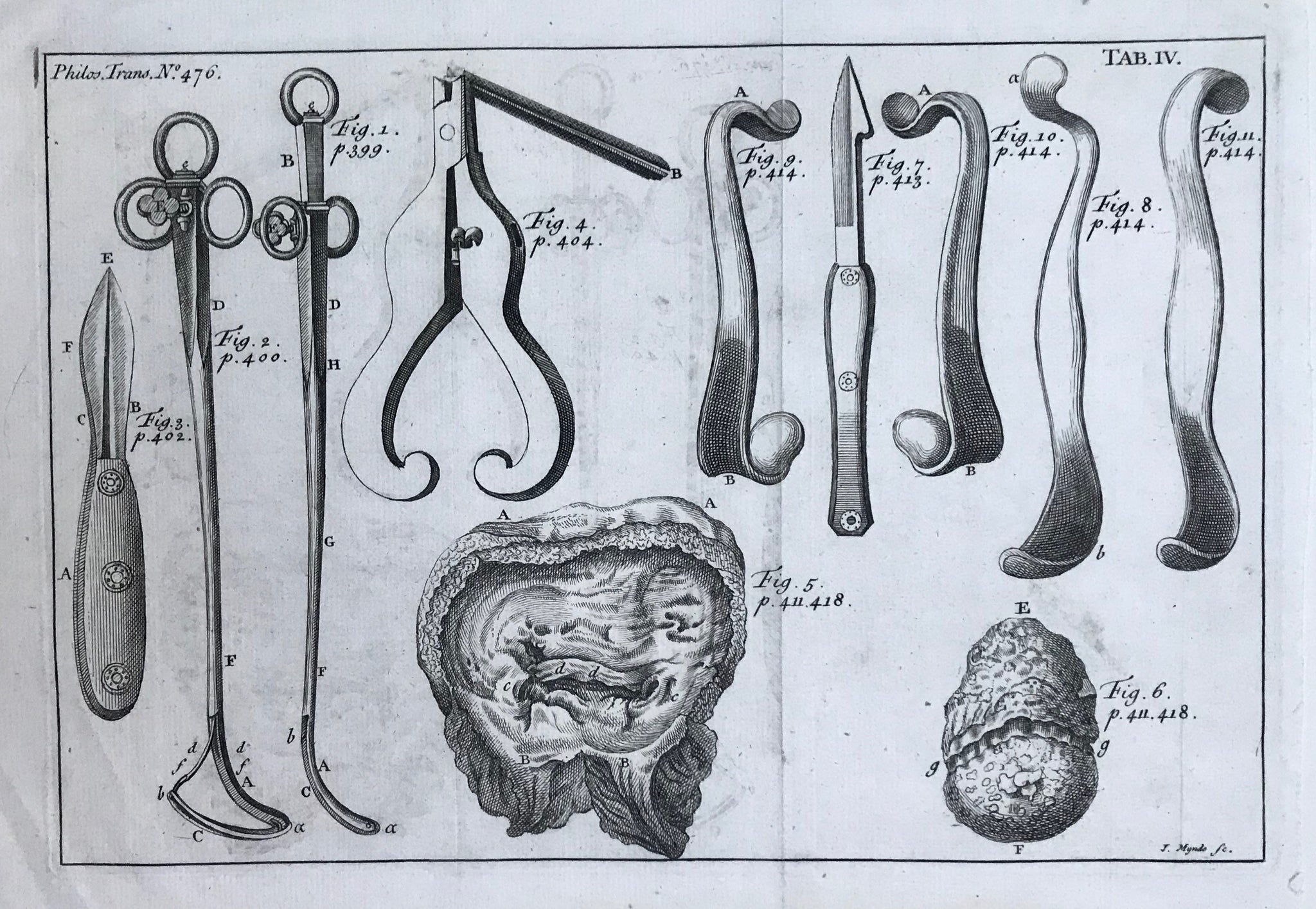 "No Title" (Gynecological instruments)  Copperplate engraving ca 1770. Vertical fold to fit book size. Very minor signs of age and use.