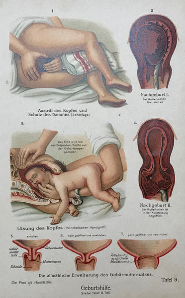 Geburtshilfe (Aiding the Birth)  Chromolithograph, 1911. Extra page of text in German., Gynecology