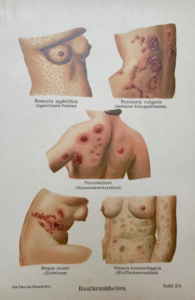 Hautkrankheiten (Skin diseases)  Chromolithograph, 1911. 