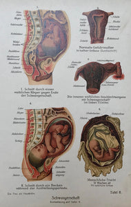 Schwangerschaft (Pregnacy)  Chromolithograph, 1911. Extra page of text in German.  Page size: 23.5 x 15.5 cm ( 9.2 x 6.1") 