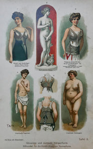 Abnorme und normale Koerperformen (Abnormal and normal body forms) Hilfsmittel fuer die Rueckenbildung zur Normalform (Aids for back for normal form)  Chromolithograph, 1911. Extra page of text in German.